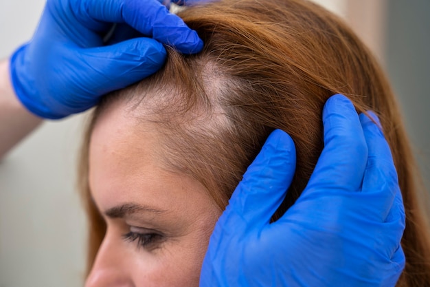 Woman getting a hair loss treatment at a clinic